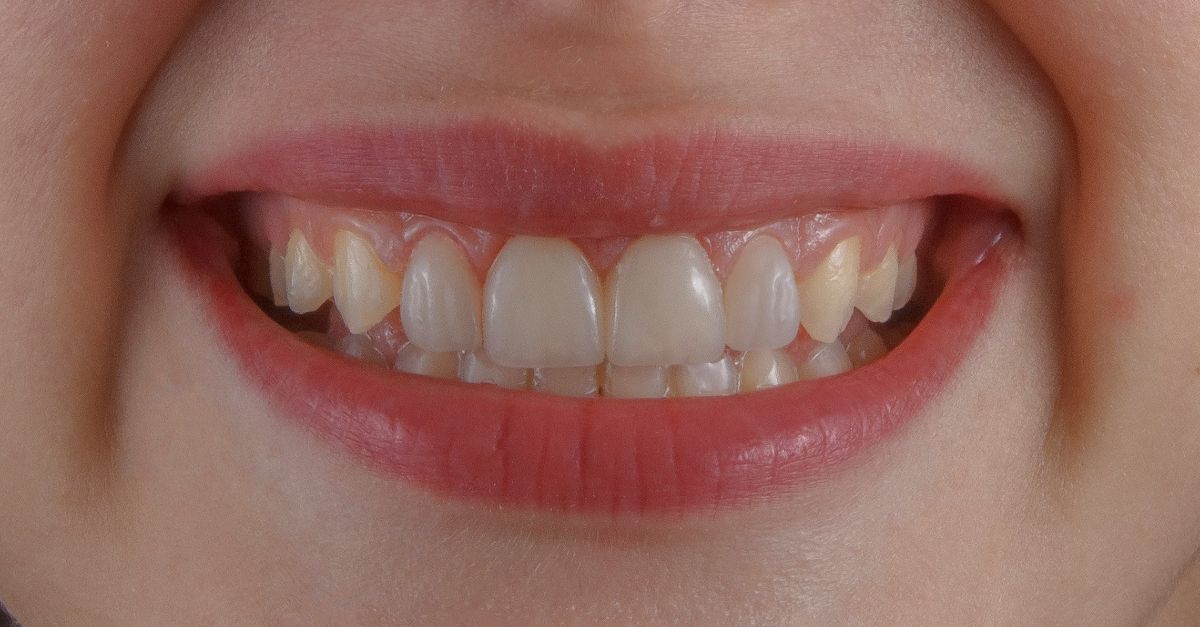 a close up of a person's mouth